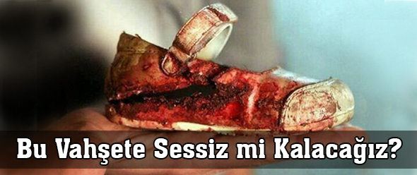 Bu Vahşete Sessiz mi Kalacağız?